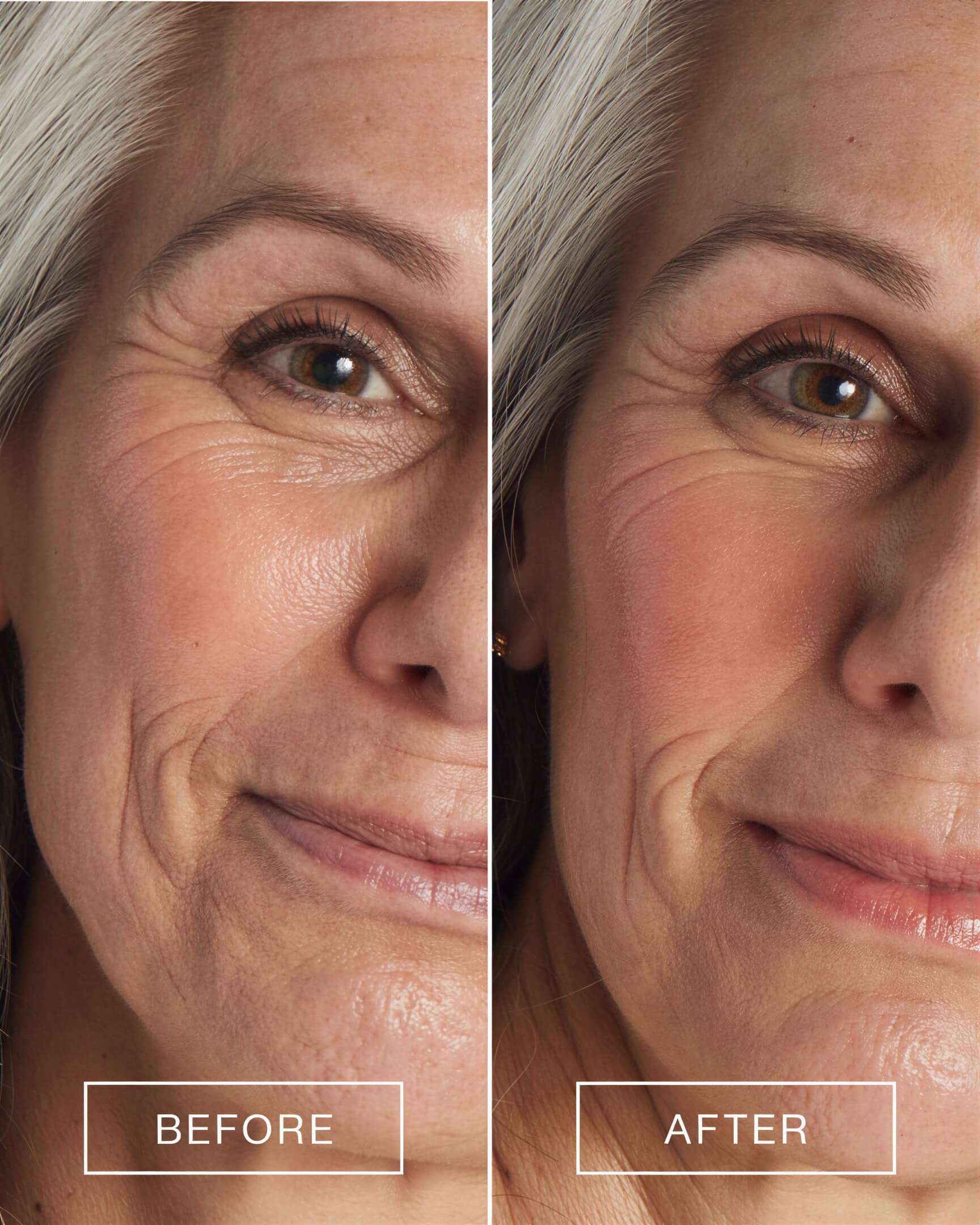 Side-by-side before and after comparison of a woman&