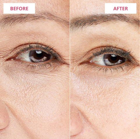 Before & After