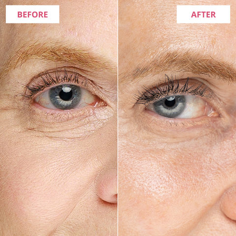 Before & After
