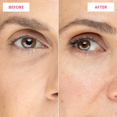 Before & After