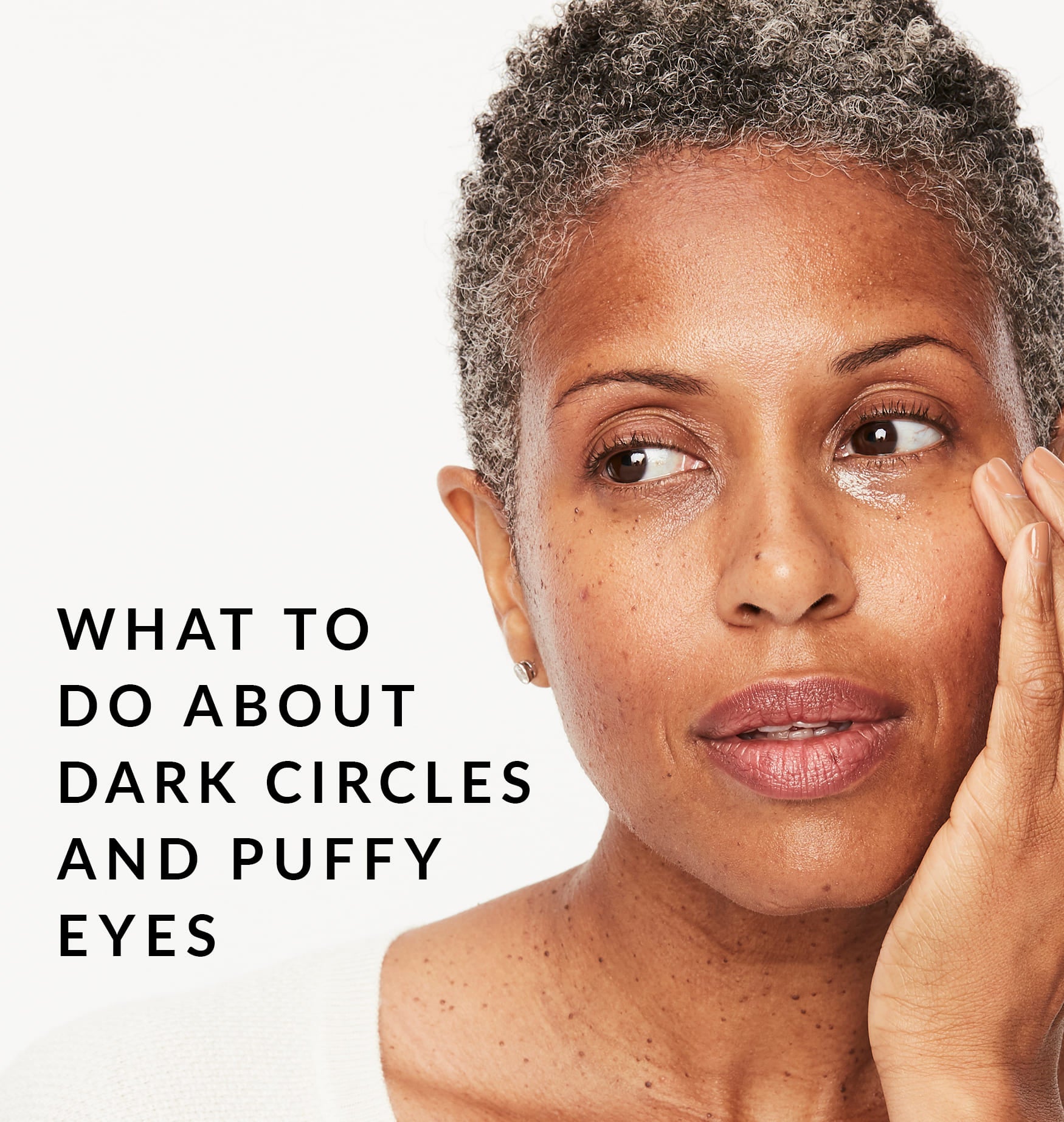 Dark Circles Puffy Eyes B COPY